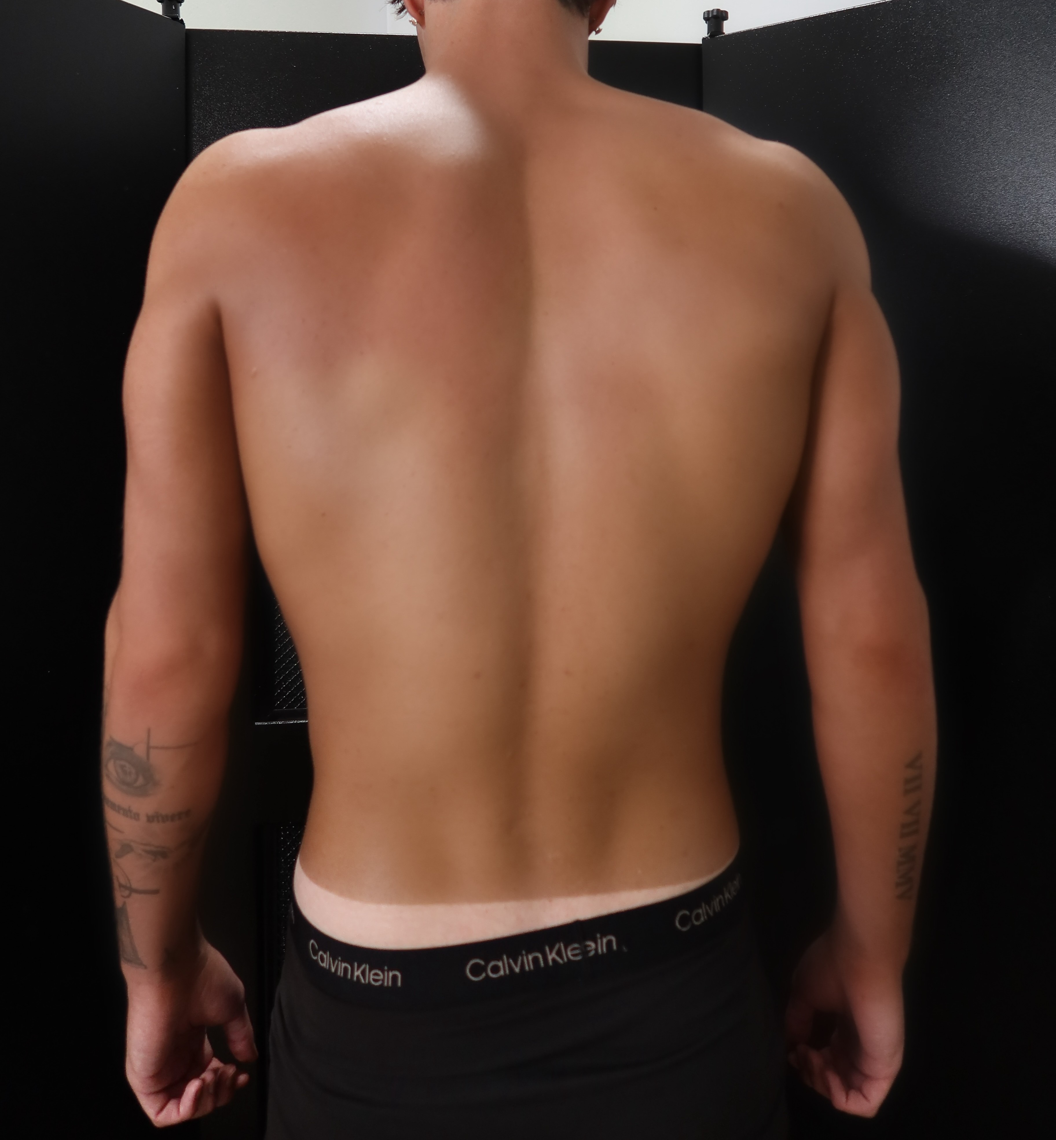 After spray tan
