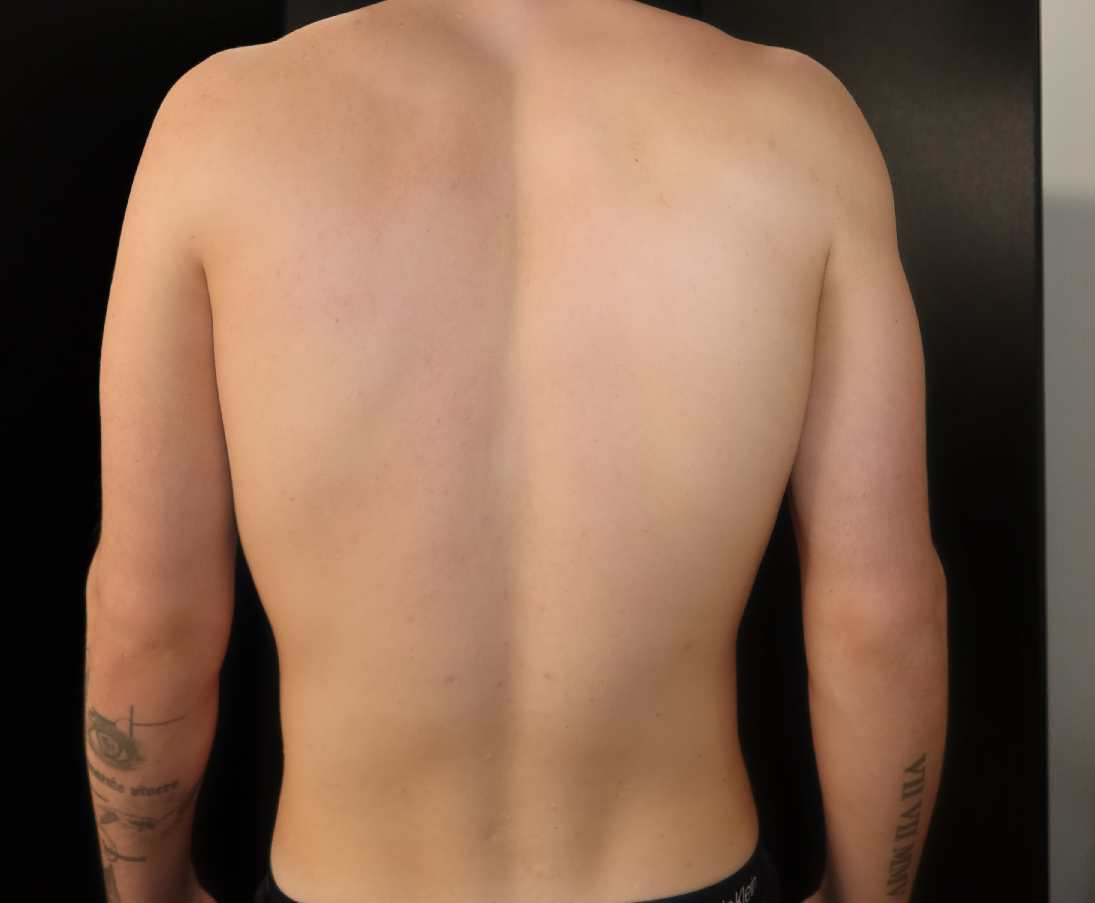 Before spray tan